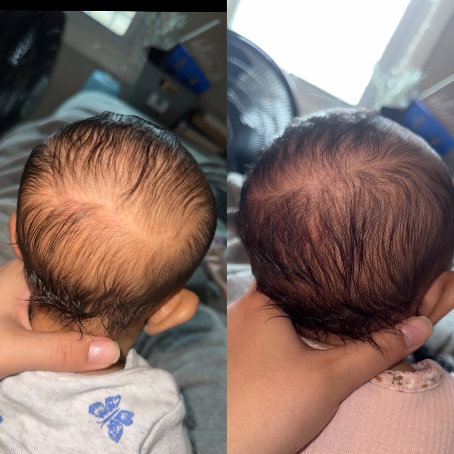 Baby Safe Hair Growth Oil